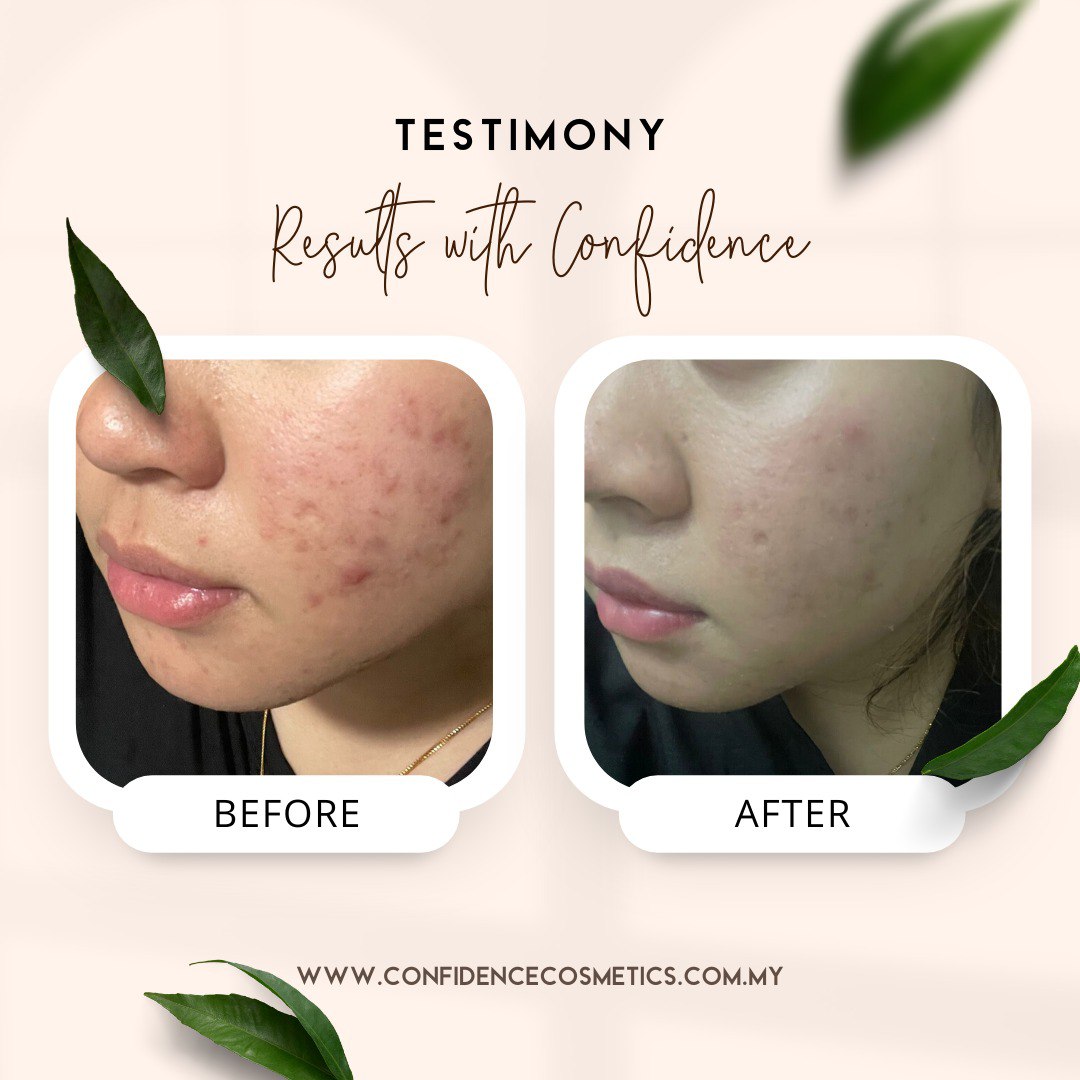 Confidence Cosmetics Testimony