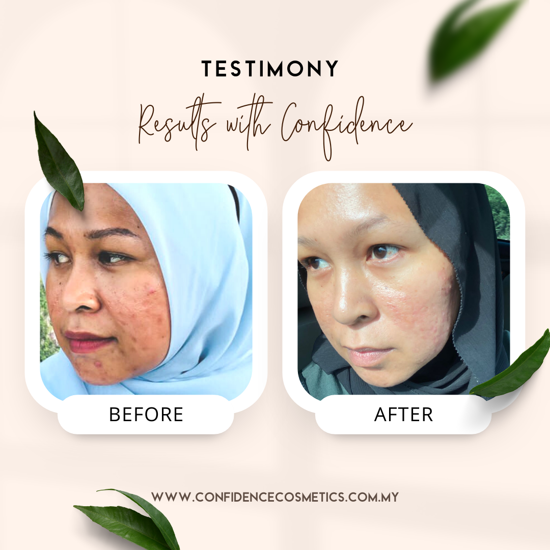 Confidence Cosmetics Testimony